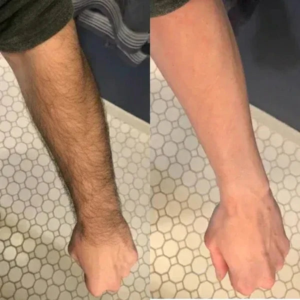 Velure Painless Hair Removal spray