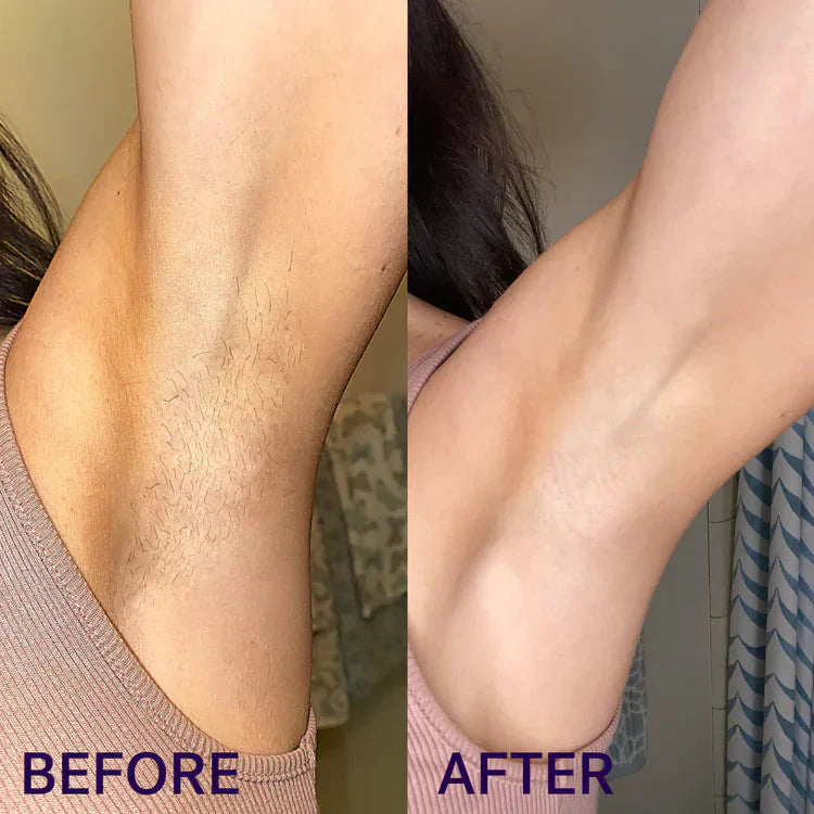 Velure Painless Hair Removal spray