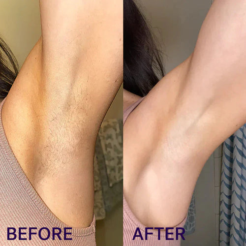 Velure Painless Hair Removal spray